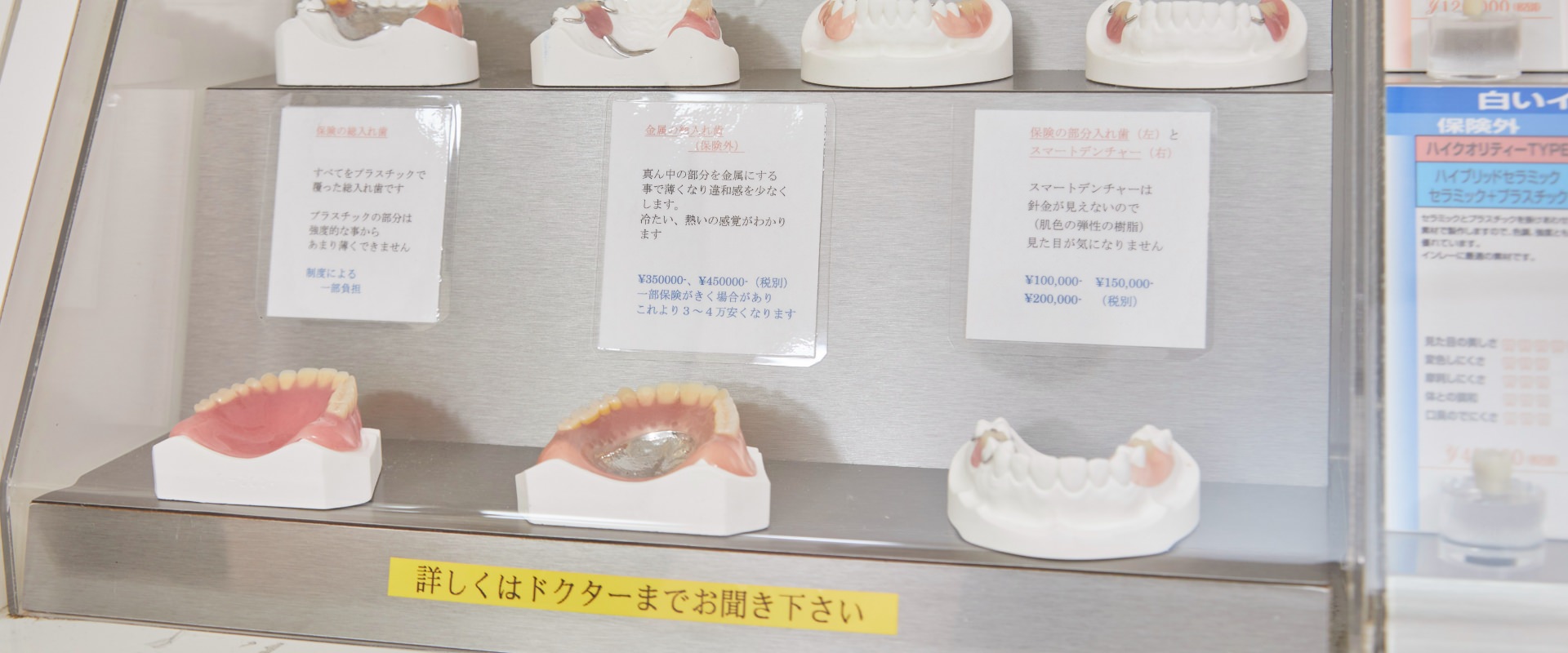 入れ歯の模型の写真