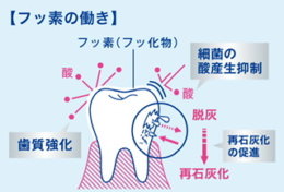 フッ素はどうやってむし歯を予防するの？
